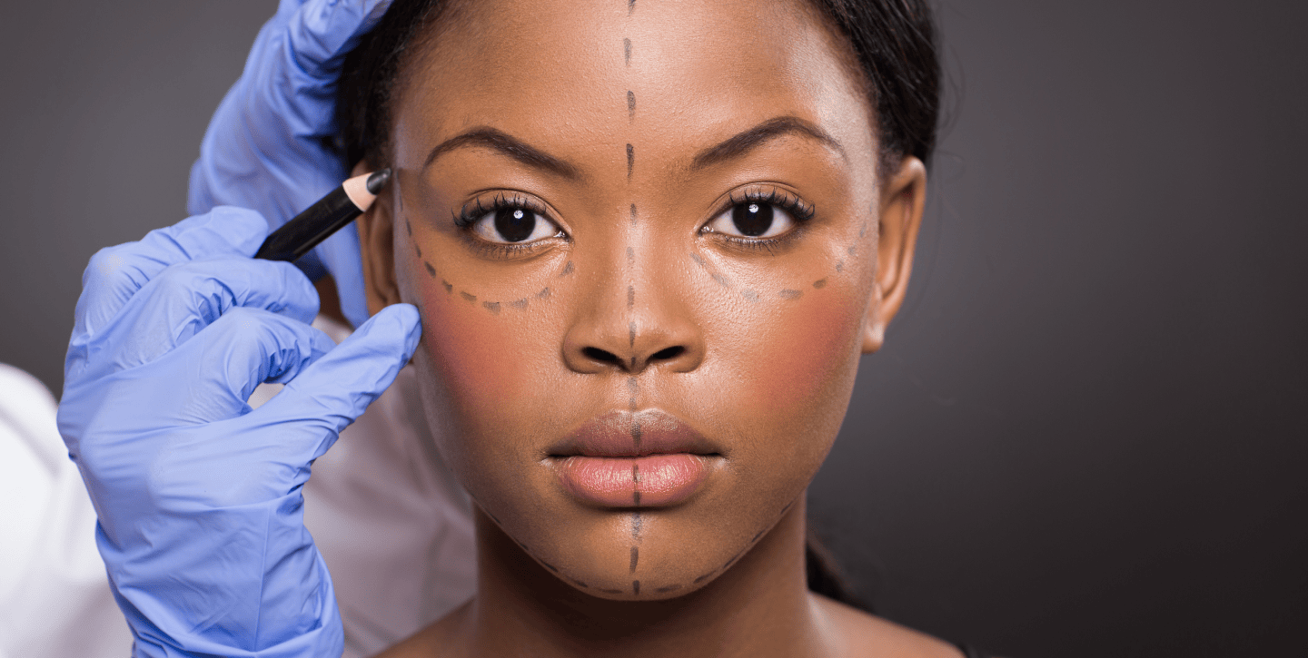 Preparation and Recovery- What to Expect Before and After a Facelift in Long Island