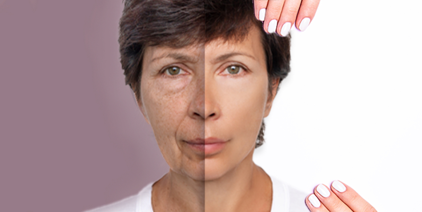 how-many-facelifts-can-a-person-have-thumbnail