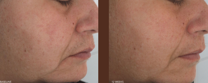 what-does-red-light-therapy-do-inner-thumb-4-767-291