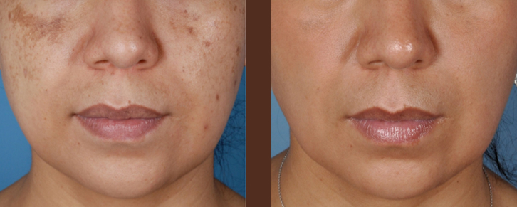 what-does-medical-skin-care-really-mean-thumbnail-inner-1