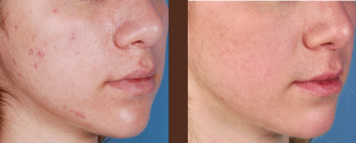 what-does-medical-skin-care-really-mean-thumbnail-inner-2