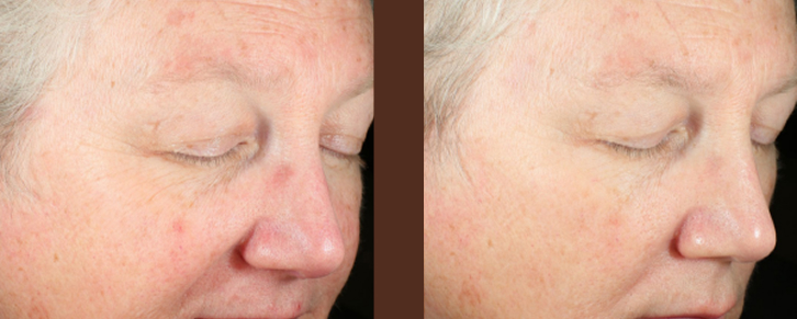 what-does-medical-skin-care-really-mean-thumbnail-inner-4