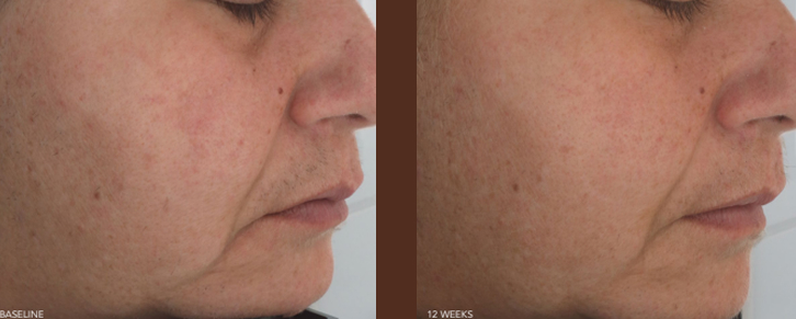 what-does-medical-skin-care-really-mean-thumbnail-inner-5