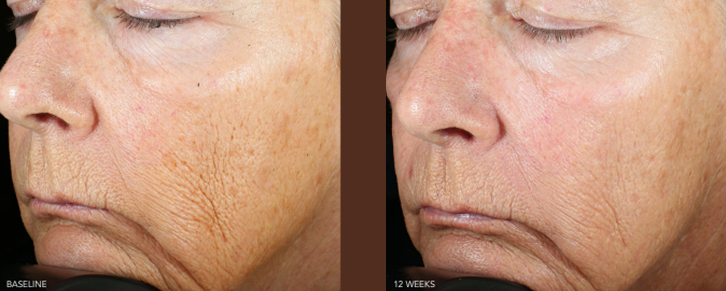 what-does-medical-skin-care-really-mean-thumbnail-inner-6