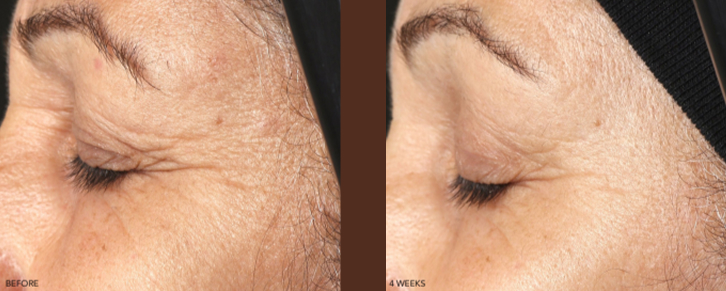 what-does-medical-skin-care-really-mean-thumbnail-inner-7