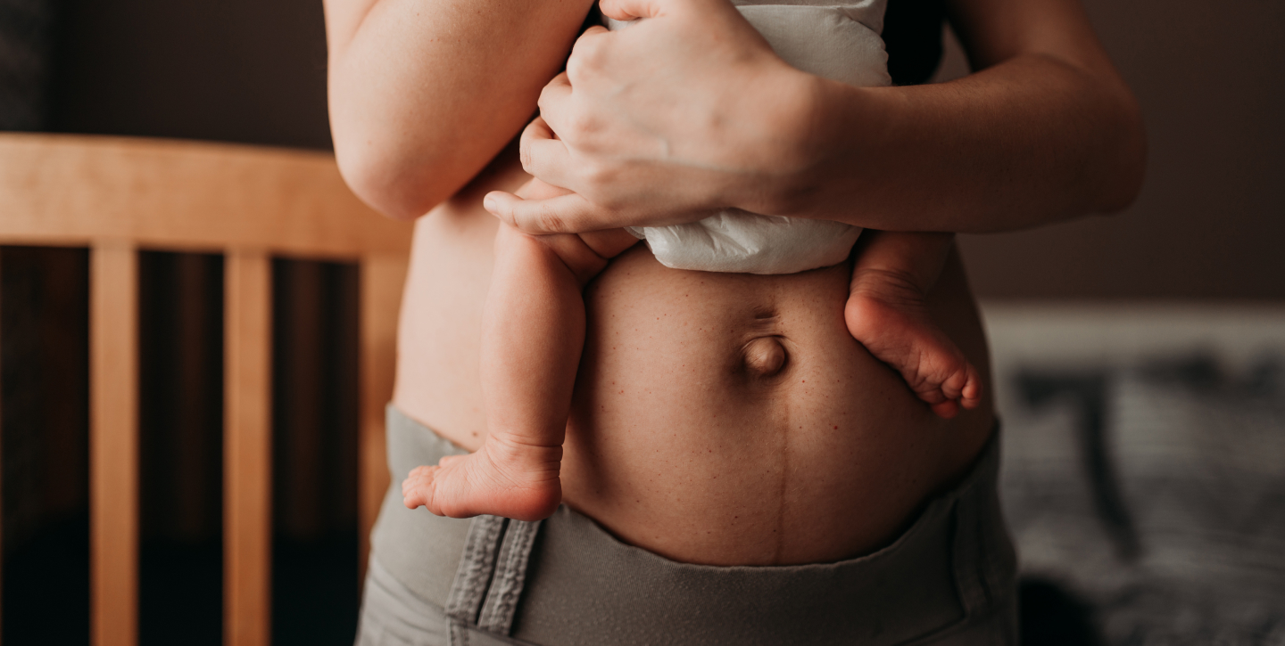 what-is-a-mommy-makeover-thumbnail-1440-725